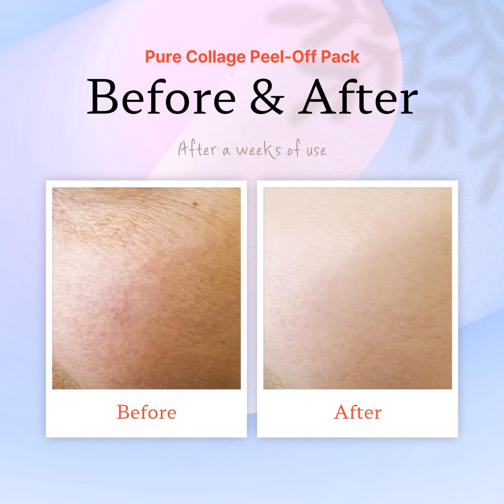 ELT COSMETICS - Pure Collagen Peel Off Wrapping Facial Mask Pack 60 ml