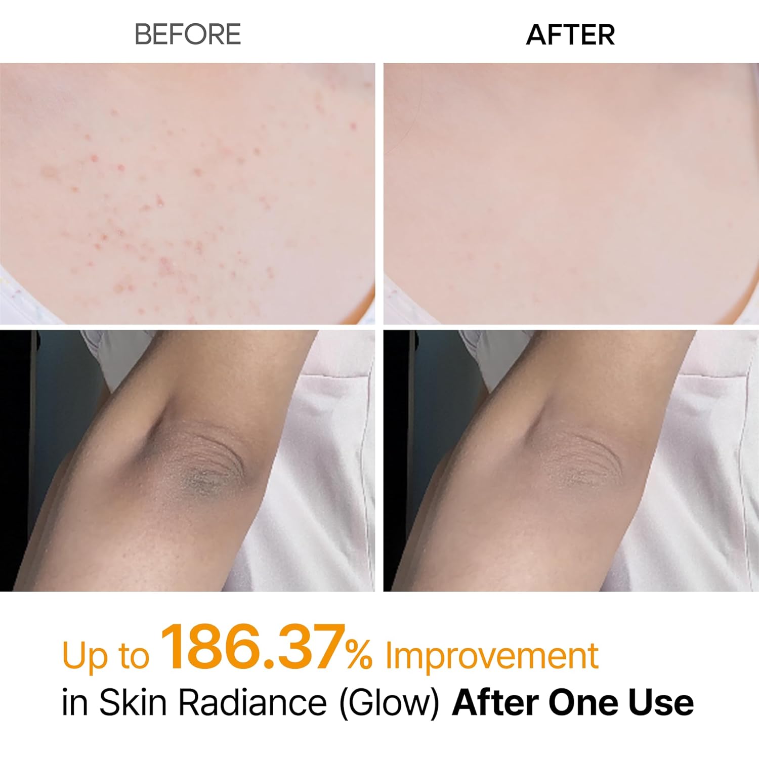 Dr.Melaxin PEEL SHOT EXFOLIATING KOJIC ACID TURMERIC SPARY 200ml