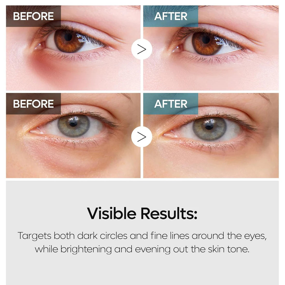 Dr.Melaxin TX Retinalsome Double Effect Eye Cream 40g