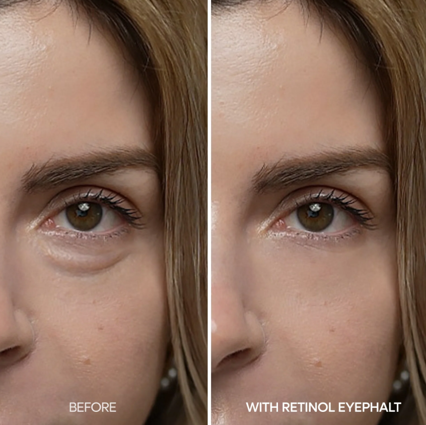 Dr.Melaxin Eyephalt Retinol Eyebag Cream 10g